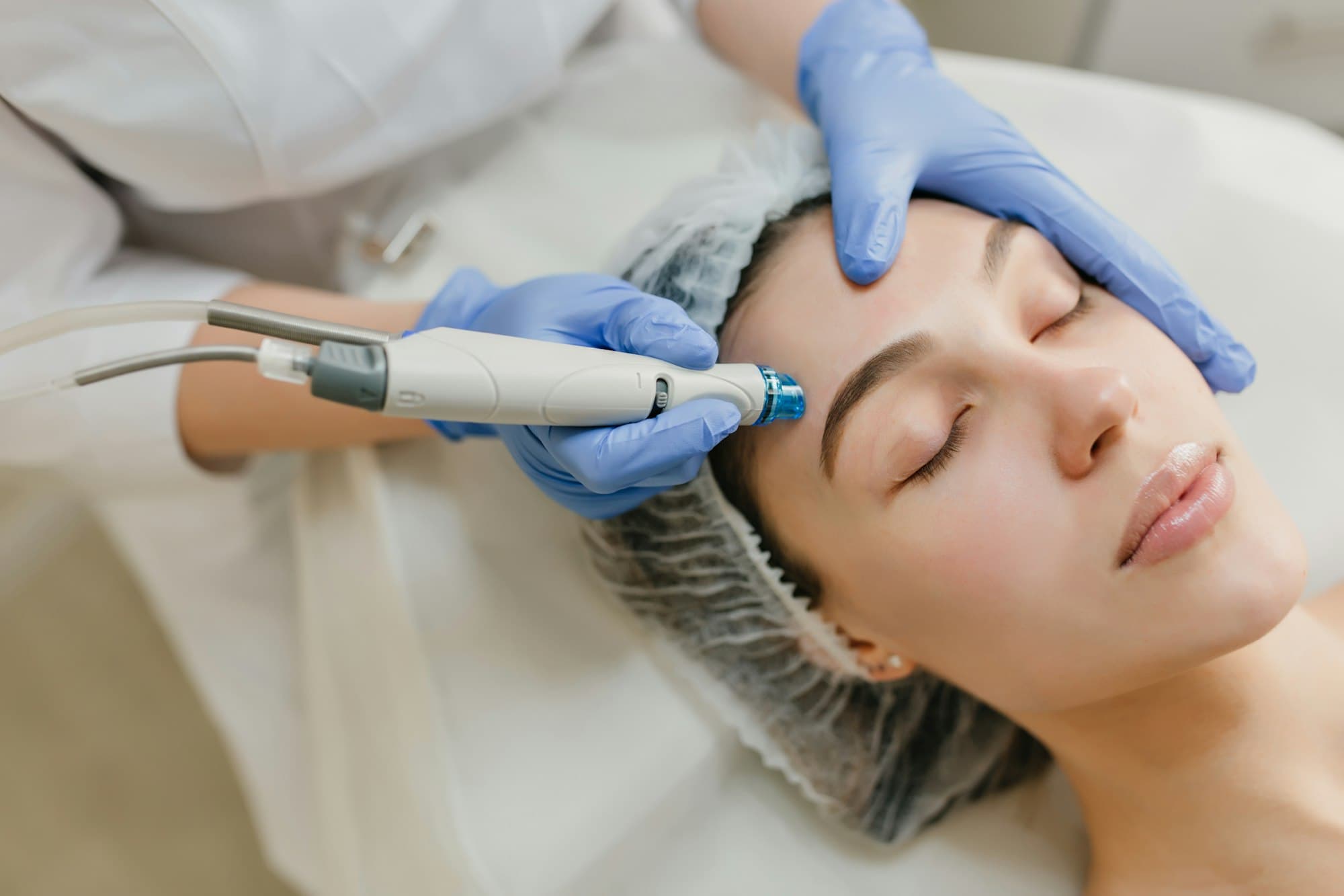 A facial peel applied by a doctor